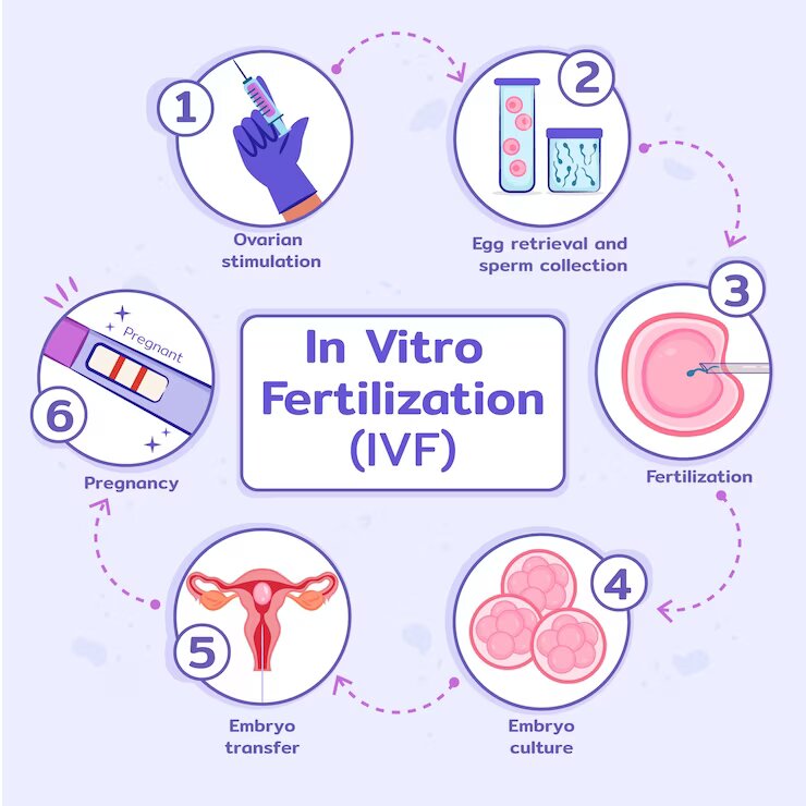 ivf process