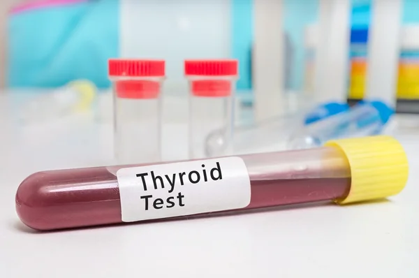 Understanding Thyroid Levels in Pregnancy: The Impact on Maternal and Fetal Health
