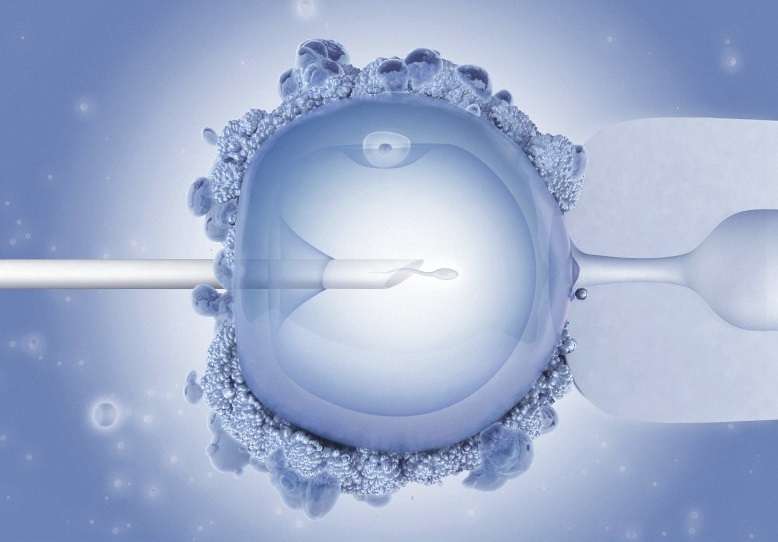 In Vitro Maturation