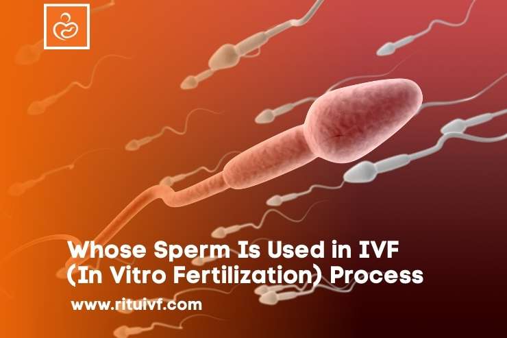 Whose Sperm Is Used in IVF (In Vitro Fertilization) Process