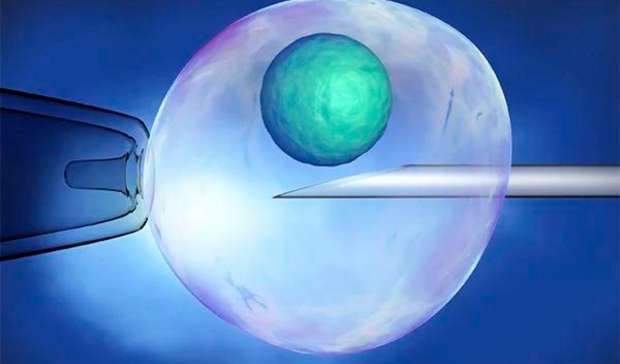 Laser Assisted Hatching (LAH) in IVF
