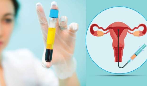 What is platelet-rich plasma (PRP) in IVF?