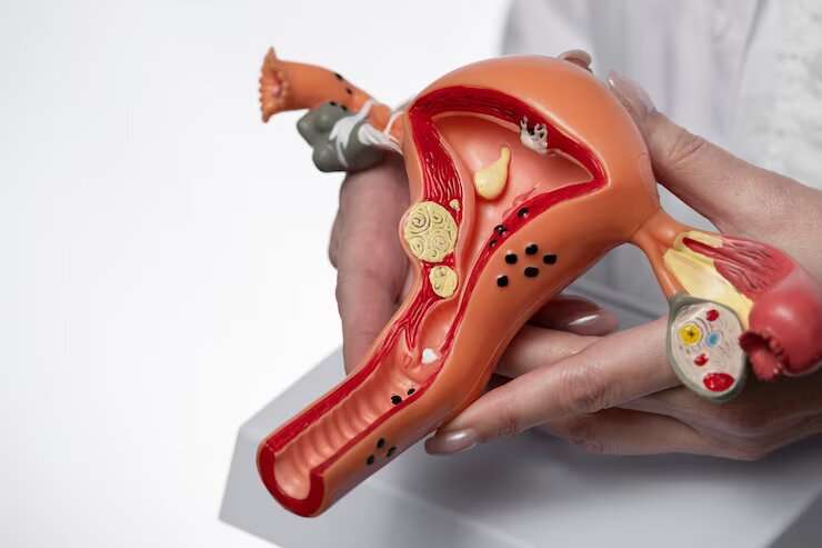 A Guide to Pelvic Reconstructive Surgery