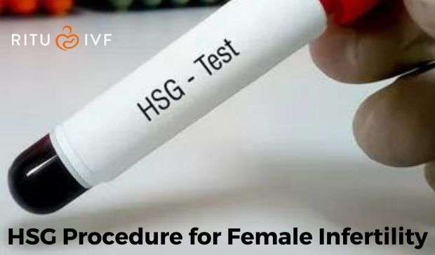 HSG Procedure (Hysterosalpingogram ) for Female Infertility