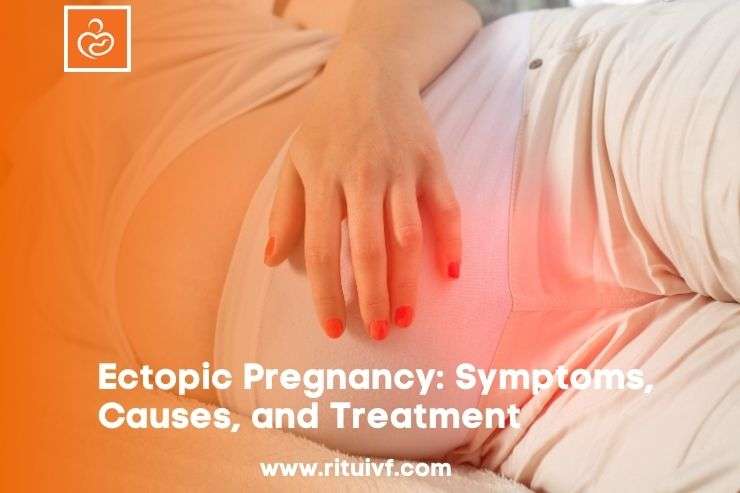 Ectopic Pregnancy Treatment, Symptoms, And Causes