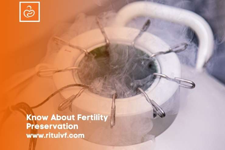 Know About Fertility Preservation Services and Treatment