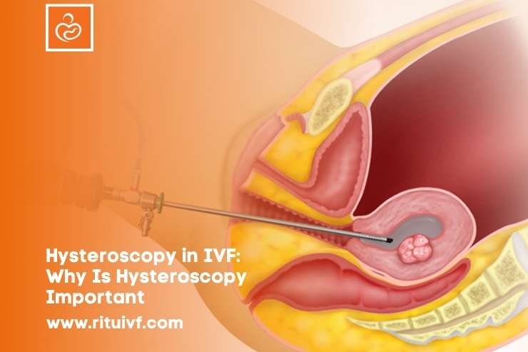 Hysteroscopy in IVF: Why Is Hysteroscopy Important Before IVF Fertility Treatment?