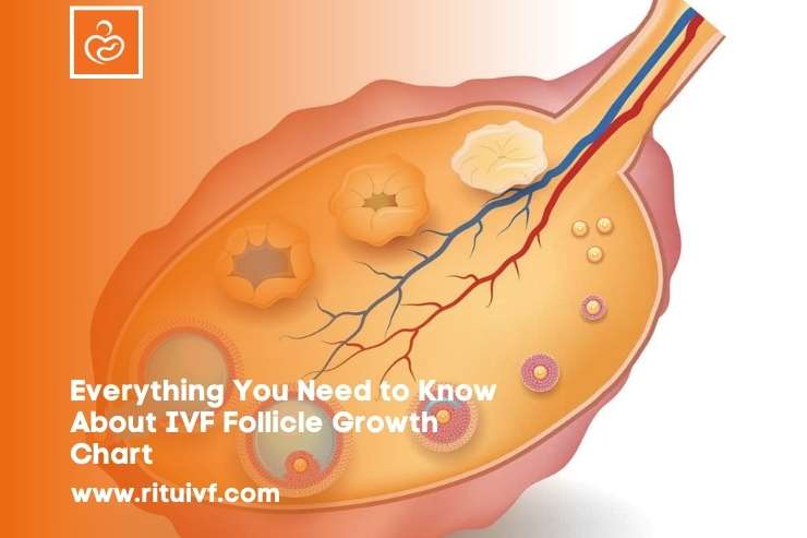 Everything You Need to Know About IVF Follicle Growth Chart 