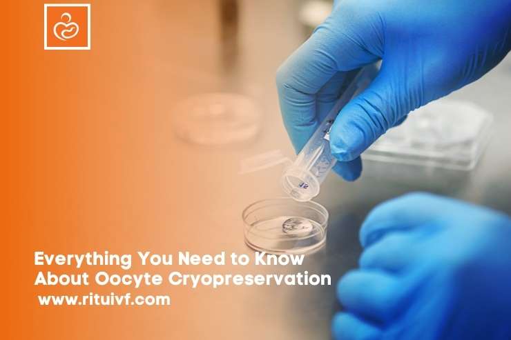 Everything You Need to Know About Oocyte Cryopreservation