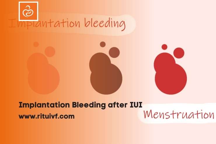Implantation Bleeding After IUI: IUI Success Symptoms and Signs of Implantation After IUI
