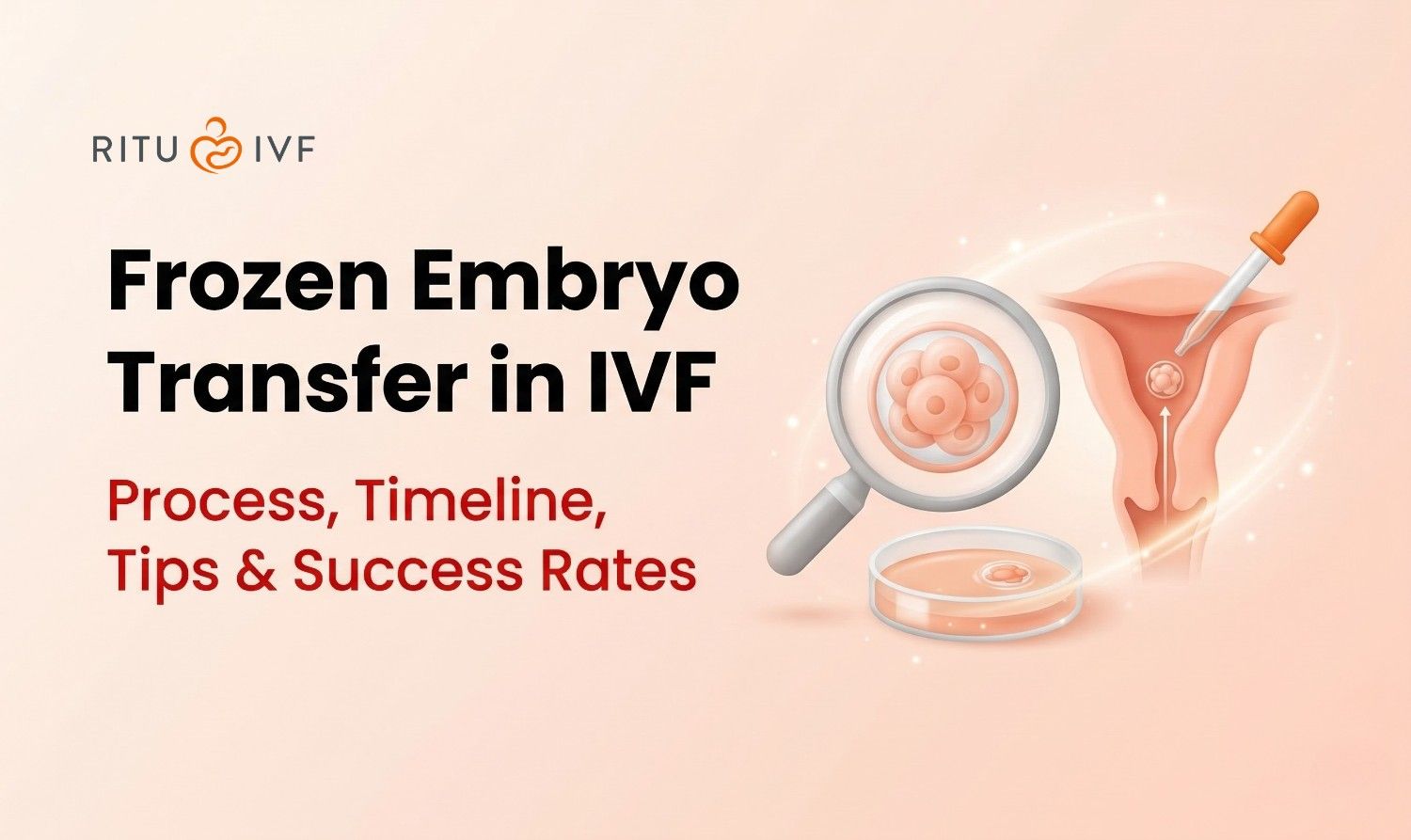 Frozen Embryo Transfer in IVF: Process, Timeline, Tips & Success Rates
